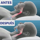 Dispositivo Medico - Bucal Anti-Ronquidos, Bruxismo y Apnea del sueño